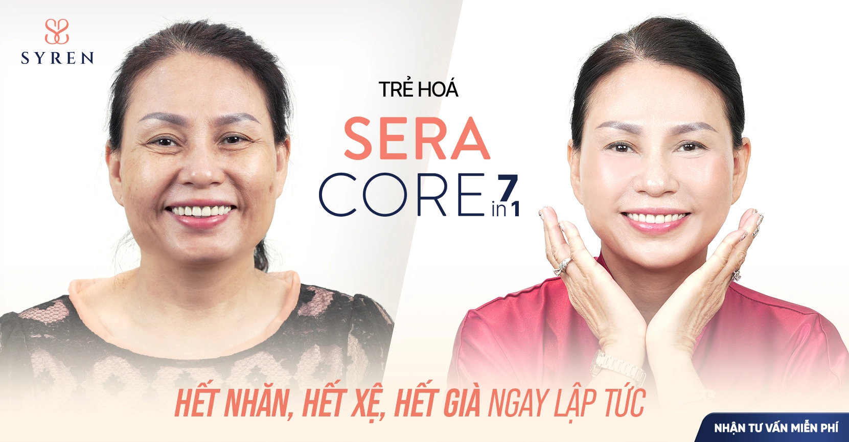 Những trường hợp nên lựa chọn nâng cơ mặt bằng SERA CORE