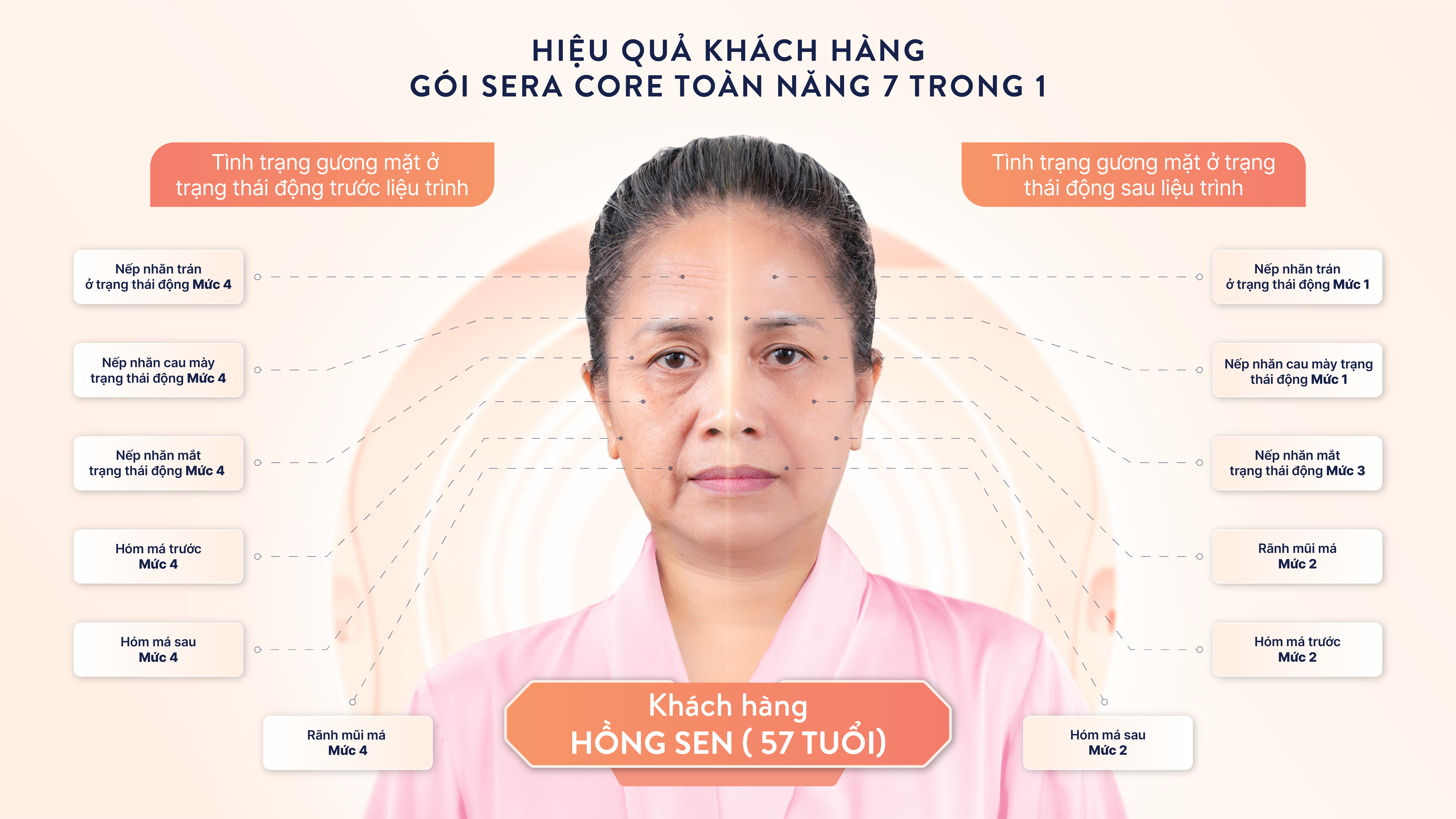 Đánh giá hiệu quả sau khi thực hiện SERA CORE 