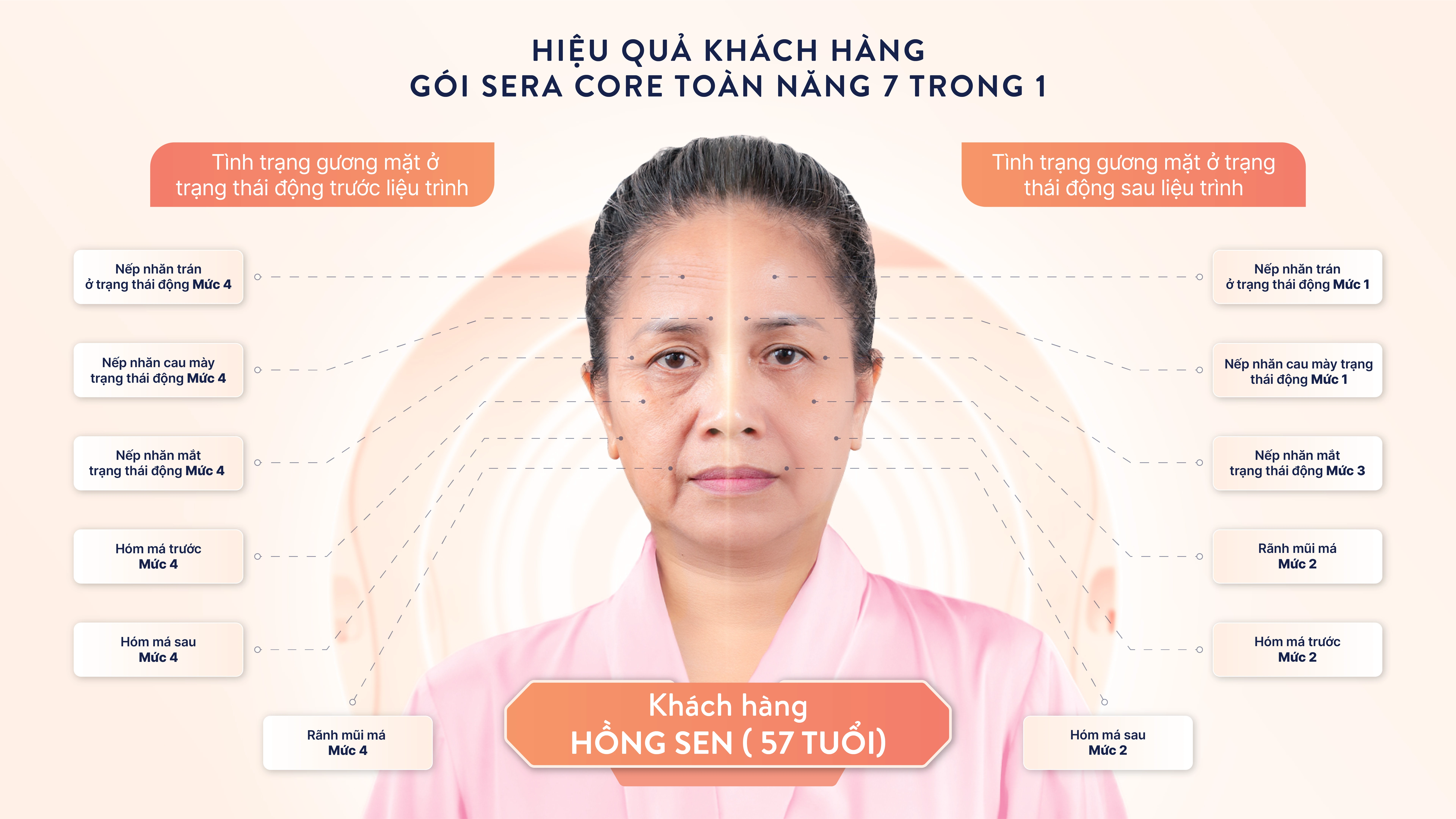 Khách hàng nhận được những gì sau khi áp dụng gói SERA CORE của SERYN?