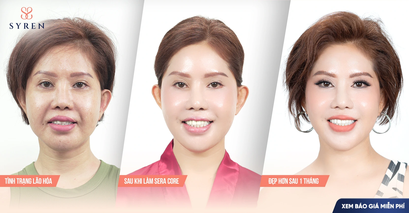 Hiệu quả sau khi thực hiện thẩm mỹ trẻ hóa tại SERYN như thế nào? 