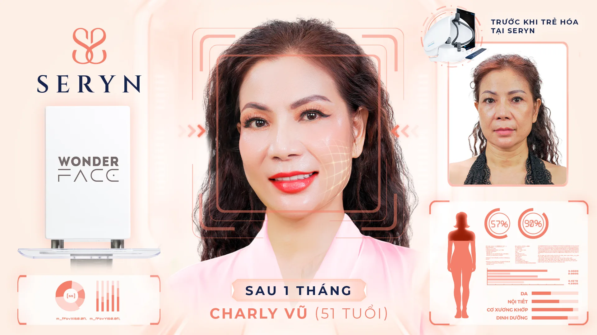 Khách hàng Charly Vũ sau 1 tháng thực hiện SERA CORE