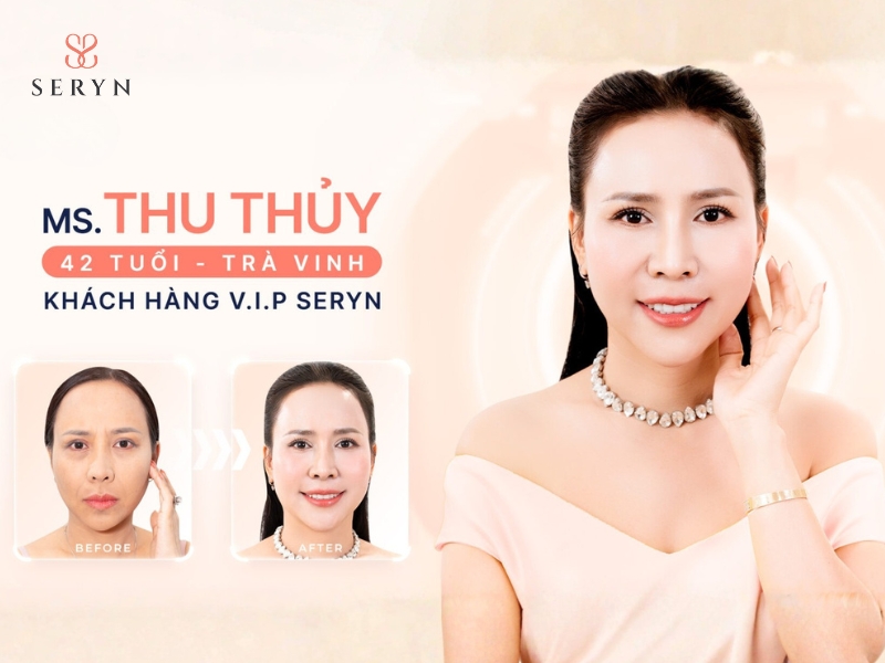 Review của Chị Thu Thủy khi làm đẹp tại Thẩm mỹ SERYN