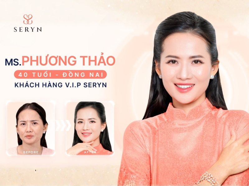 Hình ảnh trước và sau của chị Phương Thảo sau khi làm đẹp tại SERYN Clinic