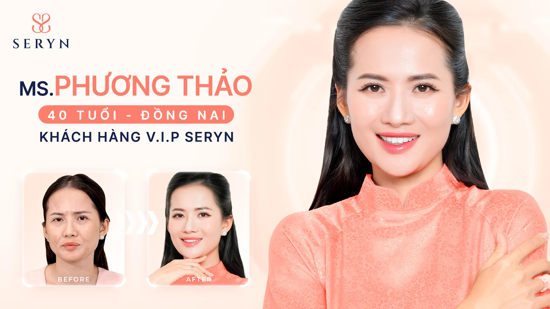 Khách hàng trước - sau thực hiện SERA CORE