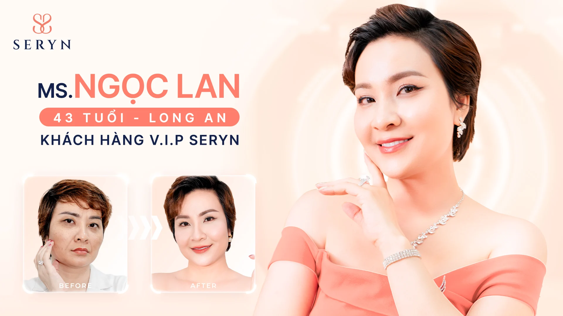 Khách hàng trước - sau thực hiện SERA CORE