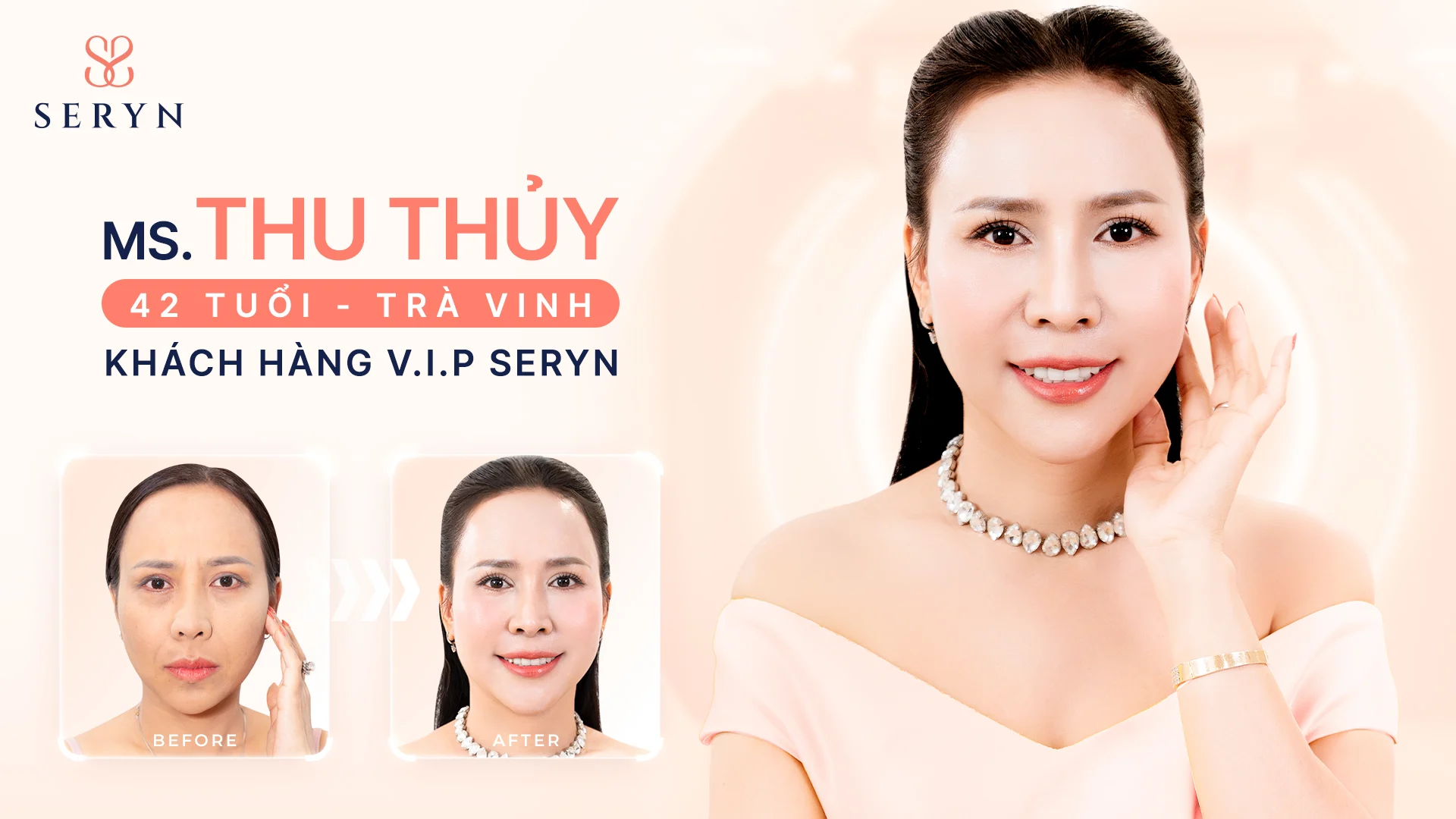 Khách hàng trước - sau thực hiện SERA CORE