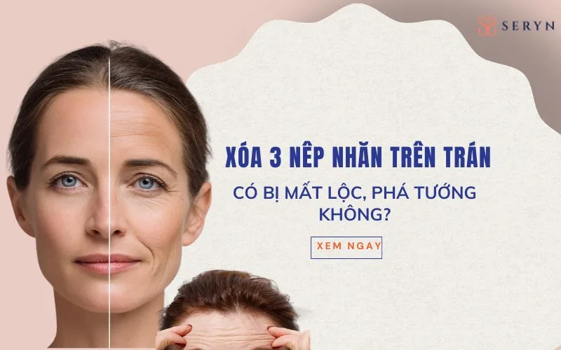 Xóa 3 nếp nhăn trên trán có bị "mất lộc, phá tướng" không?