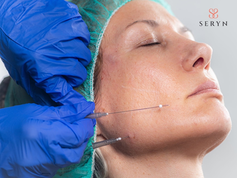 Chỉ sinh học giúp nâng đỡ mô chảy xệ Chỉ sinh học giúp nâng đỡ mô chảy xệ