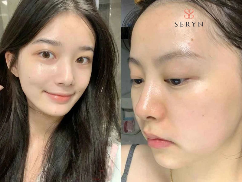 Sử dụng mỹ phẩm chứa Retinol chống lão hoá