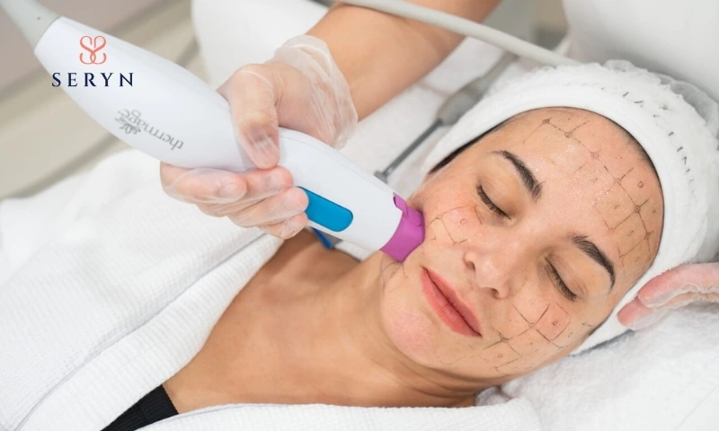 Những trường hợp nên và không nên thực hiện Thermage căng da mặt