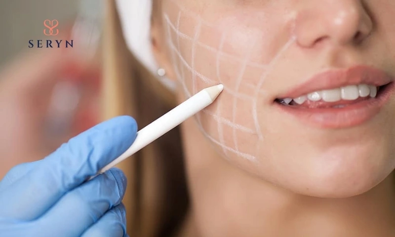 Sự khác biệt chính của các phương pháp làm căng da mặt vùng má 