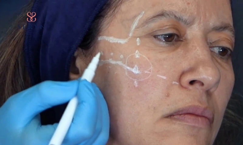 Má bị chảy xệ phải làm sao? Các yếu tố quyết định liệu trình phù hợp!