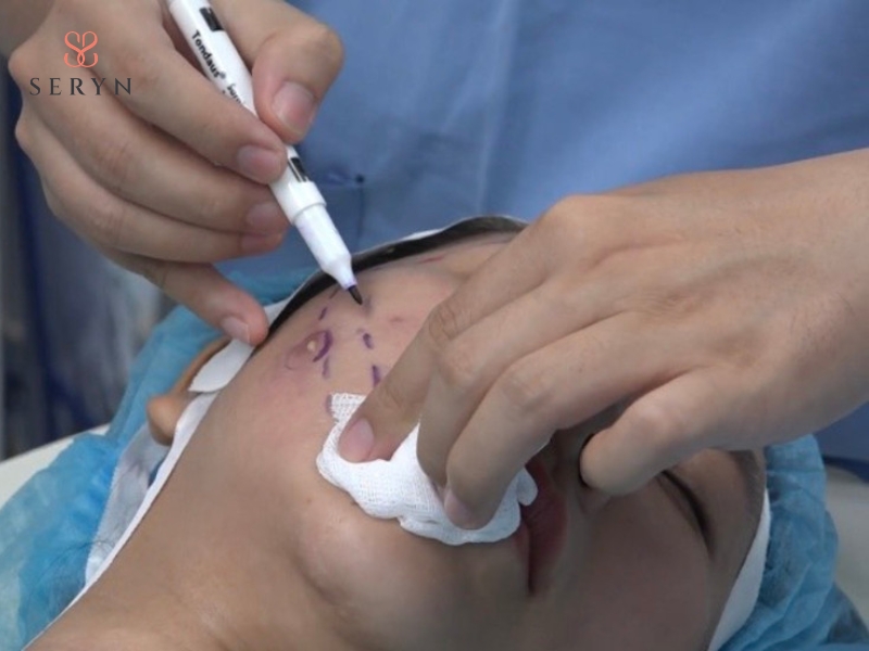 Lựa chọn sai cơ sở nâng cơ có thể gây biến chứng và giảm hiệu quả Lựa chọn sai cơ sở nâng cơ có thể gây biến chứng và giảm hiệu quả