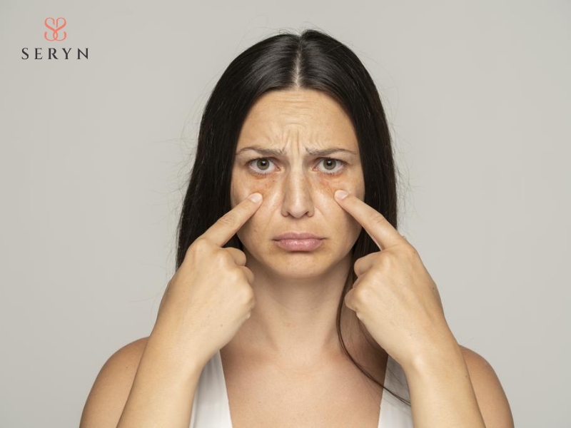 HIFU vùng mắt phù hợp với người có dấu hiệu lão hóa sớm