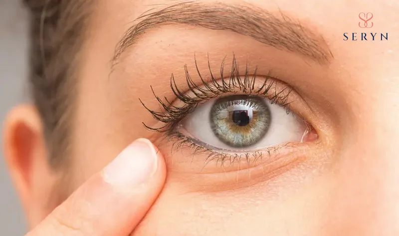 Mặt nạ dành cho mắt có thể không hiệu quả khi bạn chọn sai mục tiêu xóa nhăn 