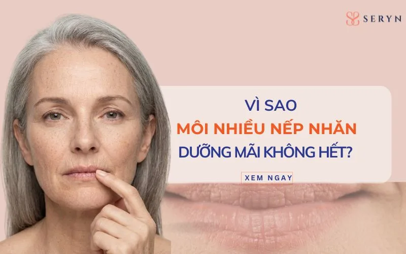 Môi nhiều nếp nhăn: Dưỡng mãi không hết? Lý do bạn đang sai cách