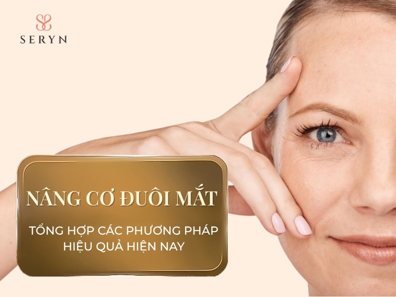 Tổng hợp các phương pháp nâng cơ đuôi mắt hiệu quả hiện nay