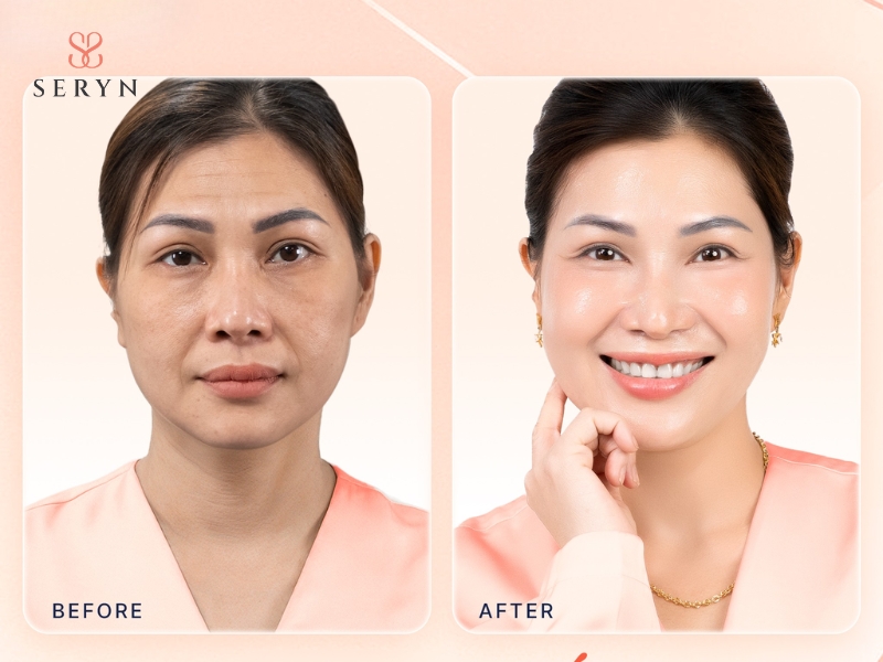 SERA CORE có mô hình trẻ hóa da đa tầng với phác đồ cá nhân hóa trong thẩm mỹ da liễu