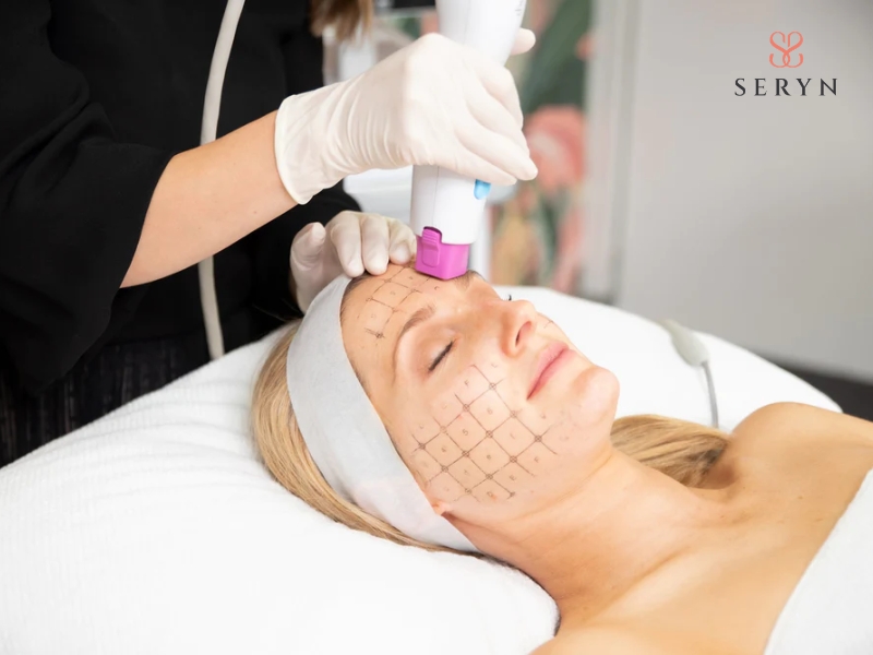 Thermage giúp làm săn chắc da và cải thiện cấu trúc bề mặt Thermage giúp làm săn chắc da và cải thiện cấu trúc bề mặt