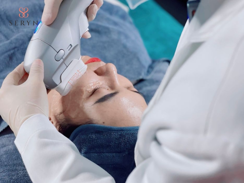 HIFU nâng cơ bằng sóng siêu âm hội tụ tác động lớp SMAS