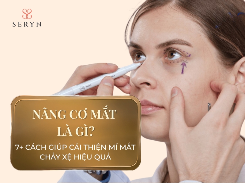 Nâng cơ mắt là gì? 7+ cách giúp cải thiện mí mắt chảy xệ hiệu quả