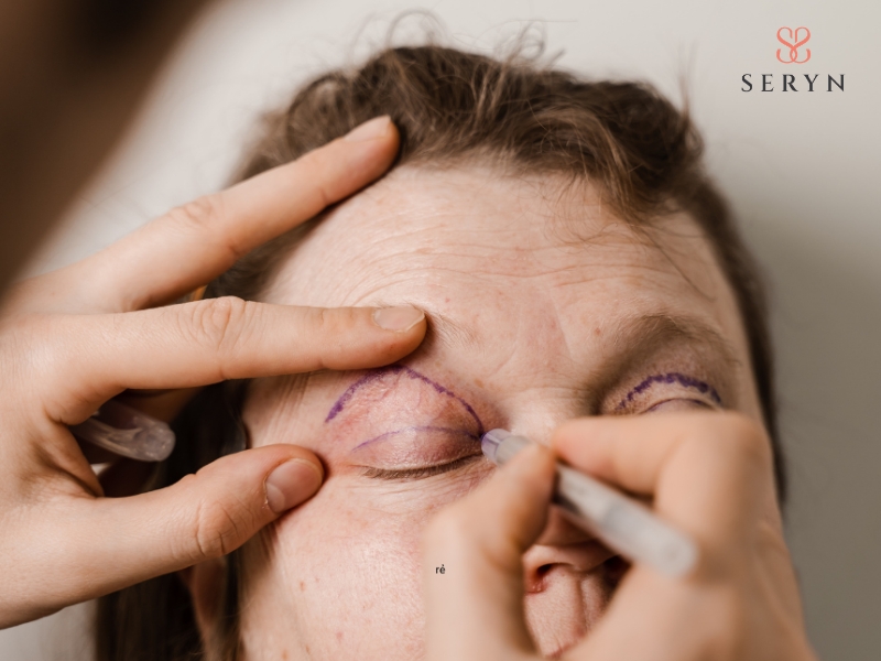 Kỹ thuật cắt da thừa mí mắt giúp nâng mí và cải thiện tầm nhìn