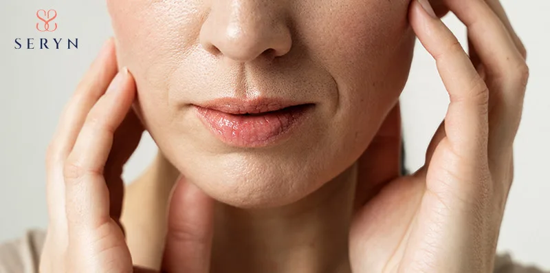 Rãnh marionette xuất hiện do trọng lực và cấu trúc nâng đỡ suy yếu