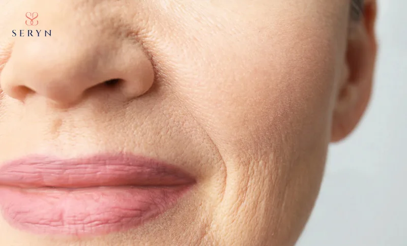 Nếp nhăn ở miệng có thể thấy rõ khi bạn bước vào giai đoạn lão hóa 