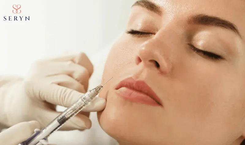 Giảm nếp nhăn khóe miệng tức thì bằng filler 