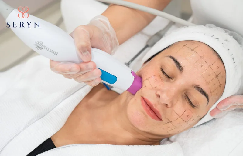  Xóa nhăn vùng miệng bằng máy nâng cơ công nghệ cao chiếm lợi thế vì hạn chế xâm lấn 