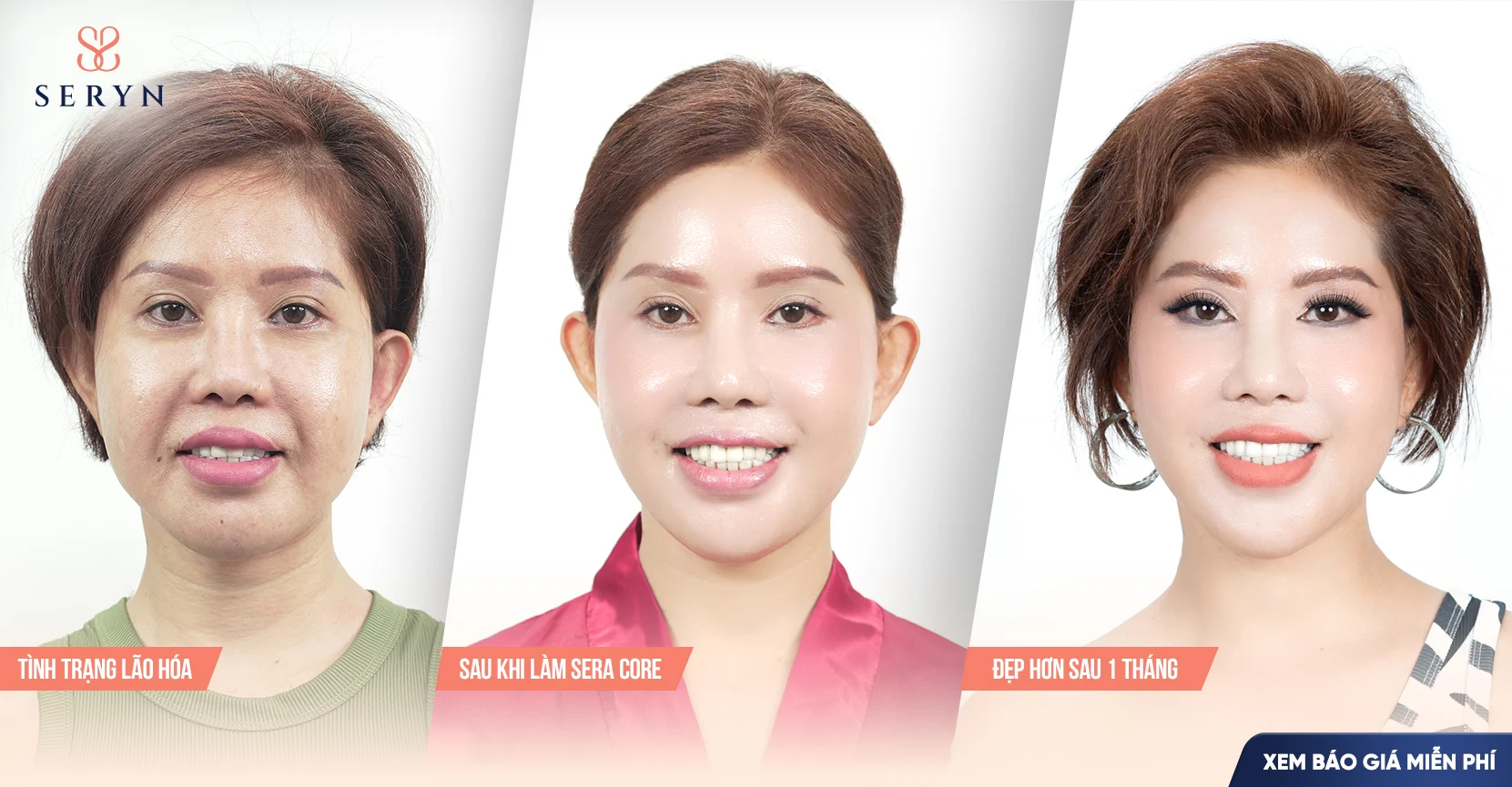 SERA CORE đem lại hiệu quả toàn diện sau khi thực hiện xóa nhăn bằng các tác động đa tầng