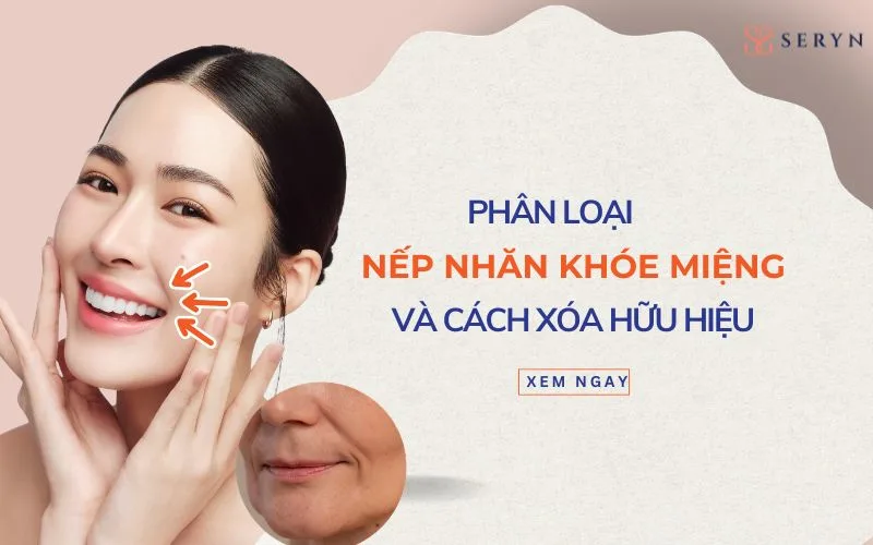 4 loại nếp nhăn khóe miệng và cách xóa nhăn hữu hiệu