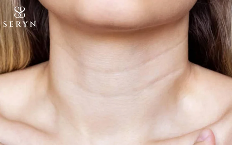 Thói quen sinh hoạt tác động lớn tới sự hình thành của các vết ngấn ở cổ 