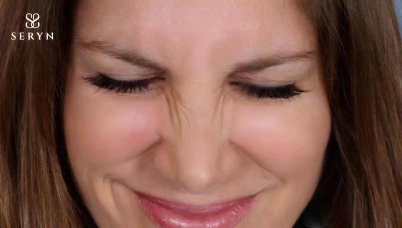 Nếp nhăn sống mũi thấy rõ khi bạn cười nói hoặc biểu cảm quá mức