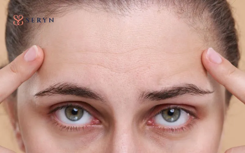 Vết nhăn giữa trán xuất hiện chủ yếu khi bạn chuyển động biểu cảm thường xuyên