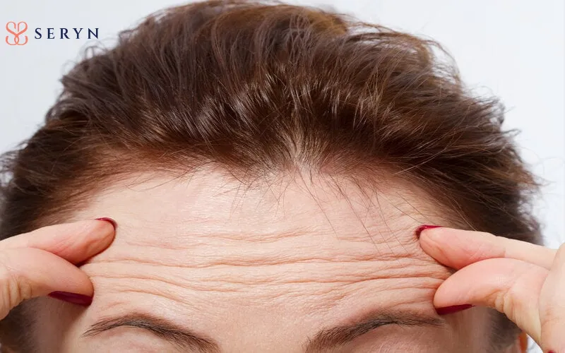 Trán nhiều nếp nhăn sâu thường biểu hiện rõ khi bạn bước sang độ tuổi ngoài 40