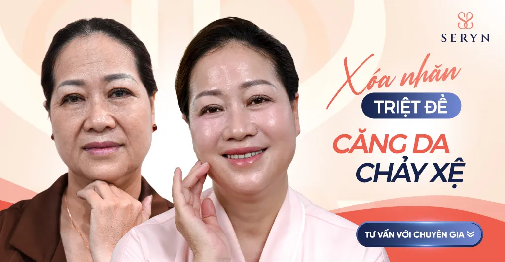 Xoá nhăn hiệu quả với nếp nhăn trên trán bằng SERA CORE