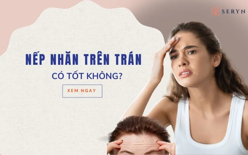 Nếp nhăn trên trán có tốt không? Chuyên gia giải đáp