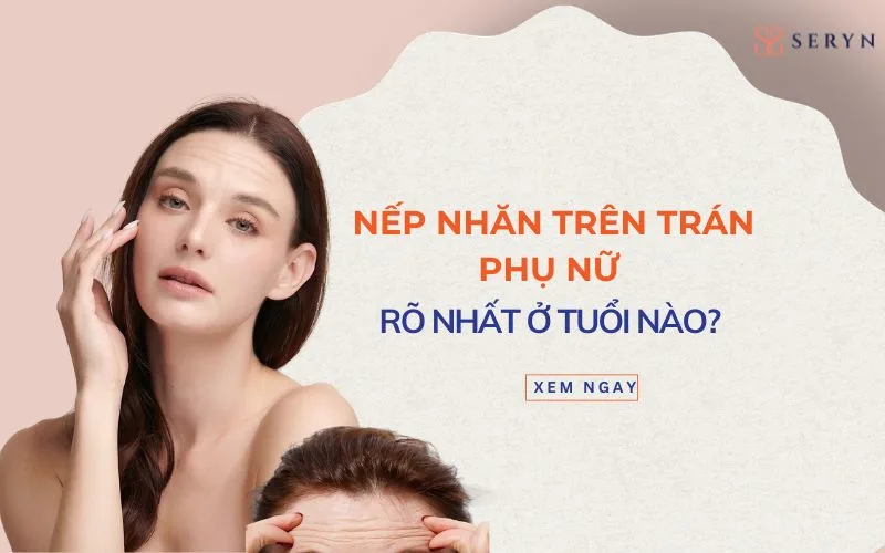 Nếp nhăn trên trán phụ nữ rõ nhất ở tuổi nào? Bao giờ cần can thiệp?