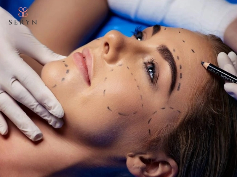 Phẫu thuật nâng cơ mặt cải thiện da chảy xệ và nếp nhăn sâu hiệu quả