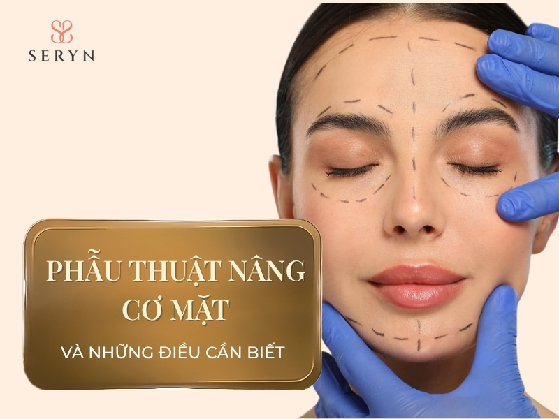 Phẫu thuật nâng cơ mặt và những điều cần biết