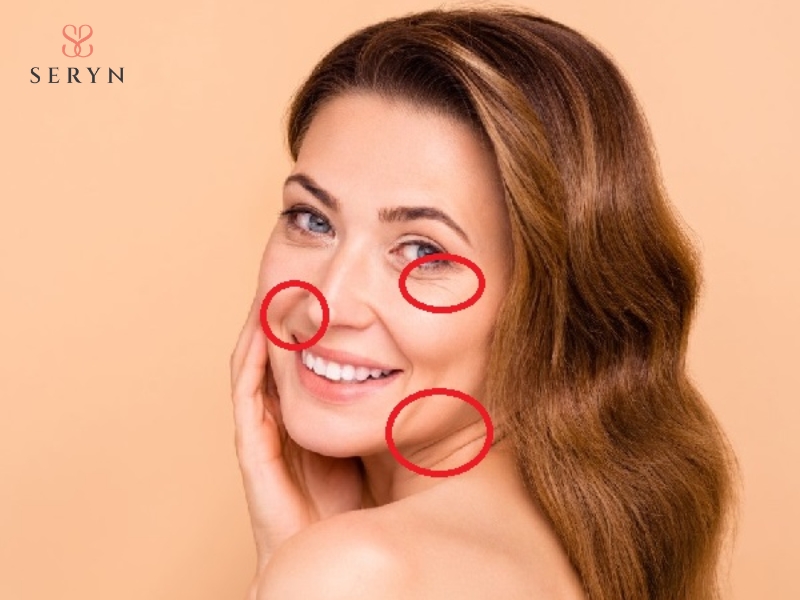 Dấu hiệu da chảy xệ, rãnh nhăn sâu cần can thiệp nâng cơ Dấu hiệu da chảy xệ, rãnh nhăn sâu cần can thiệp nâng cơ