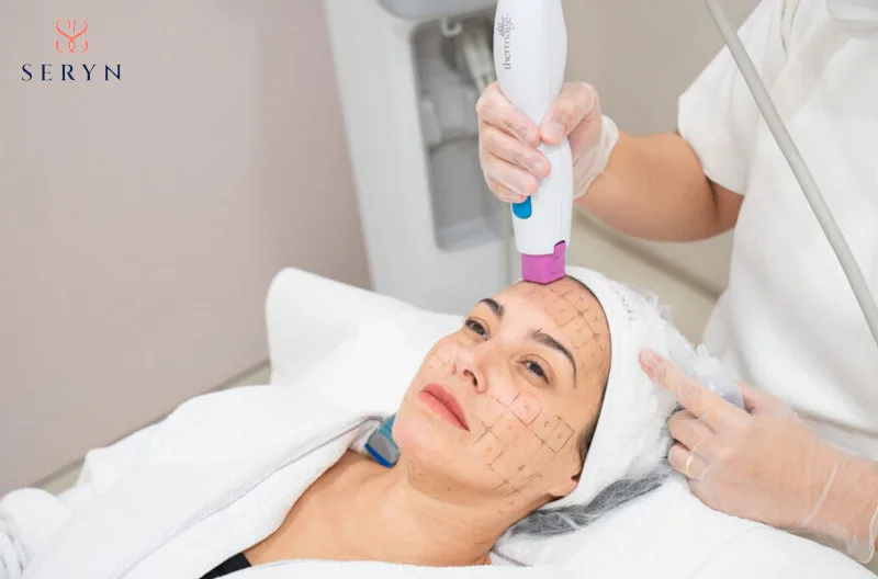 Phương pháp sử dụng nhiệt lượng trẻ hóa vùng trán hiệu quả