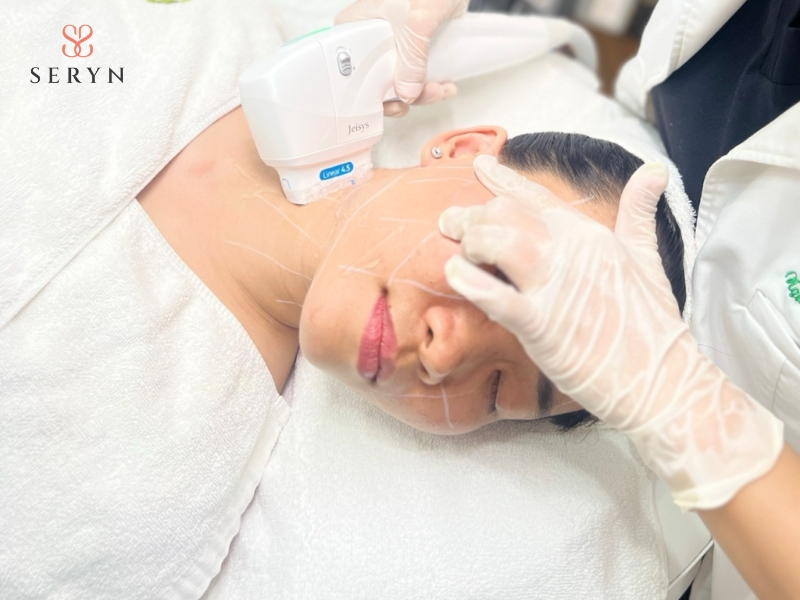 Quy trình Ultherapy được thực hiện theo tiêu chuẩn an toàn y khoa Quy trình Ultherapy được thực hiện theo tiêu chuẩn an toàn y khoa