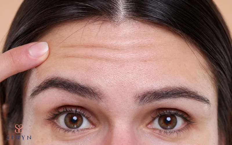 Xóa nếp nhăn vùng trán sẽ khó hiệu quả nếu không có quy chuẩn khi thực hiện