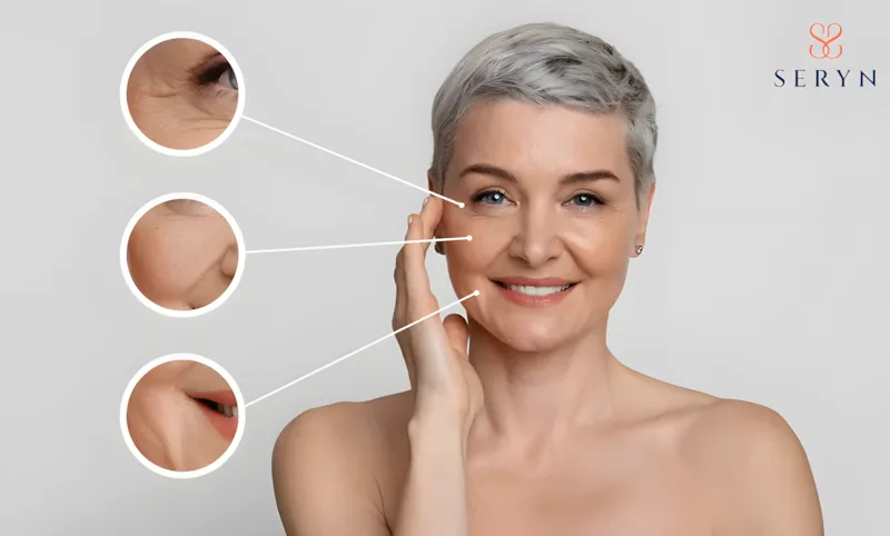 Nếp nhăn có thể thấy khi bạn chuyển động, biểu lộ cảm xúc hoặc không