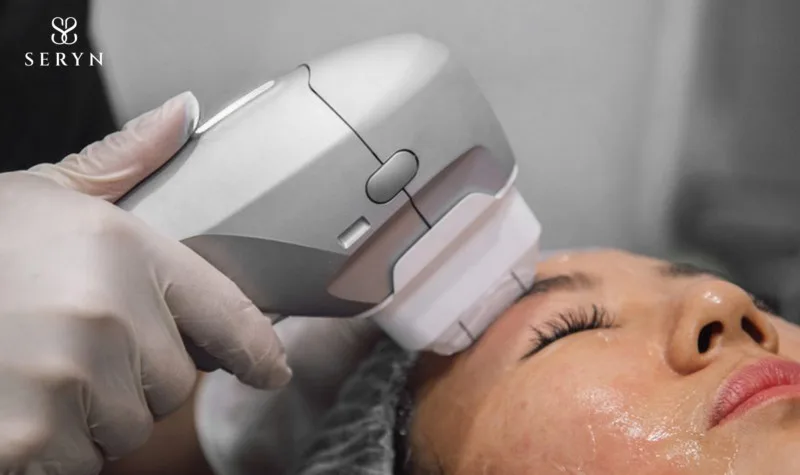 Hifu là cách giảm nếp nhăn trên trán được nhiều chị em lựa chọn