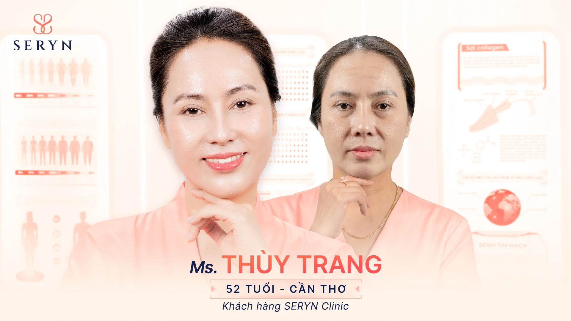 moi-guong-mat-la-bai-toan-tre-hoa-2