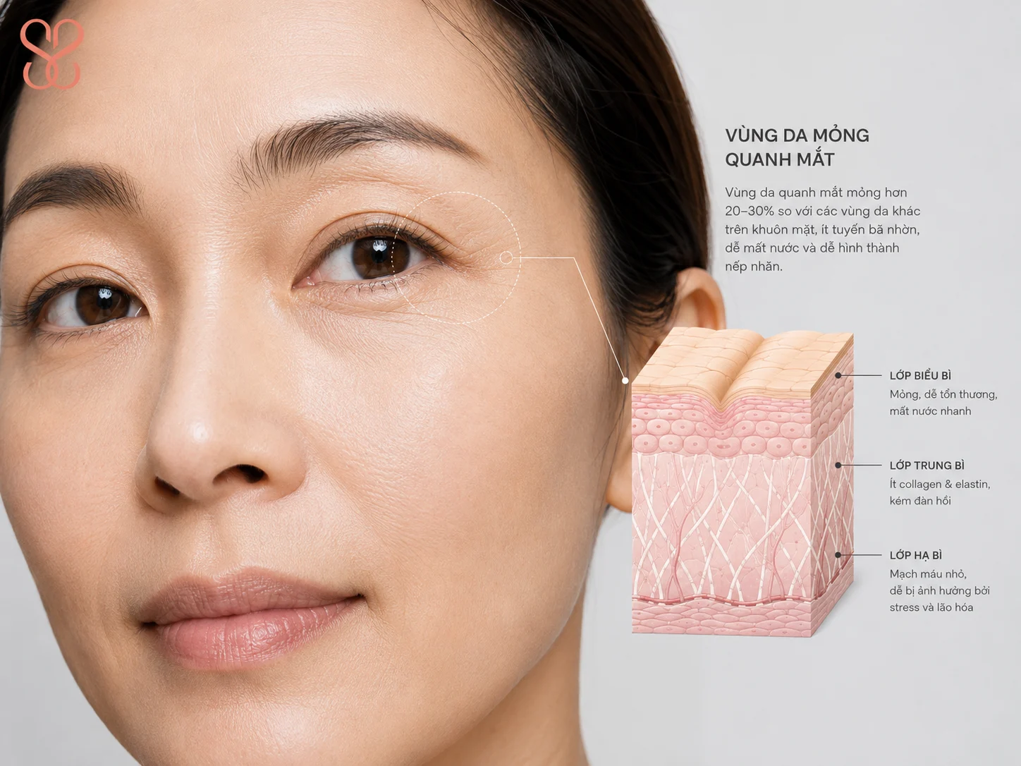 7 cách xoá nếp nhăn vung mắt