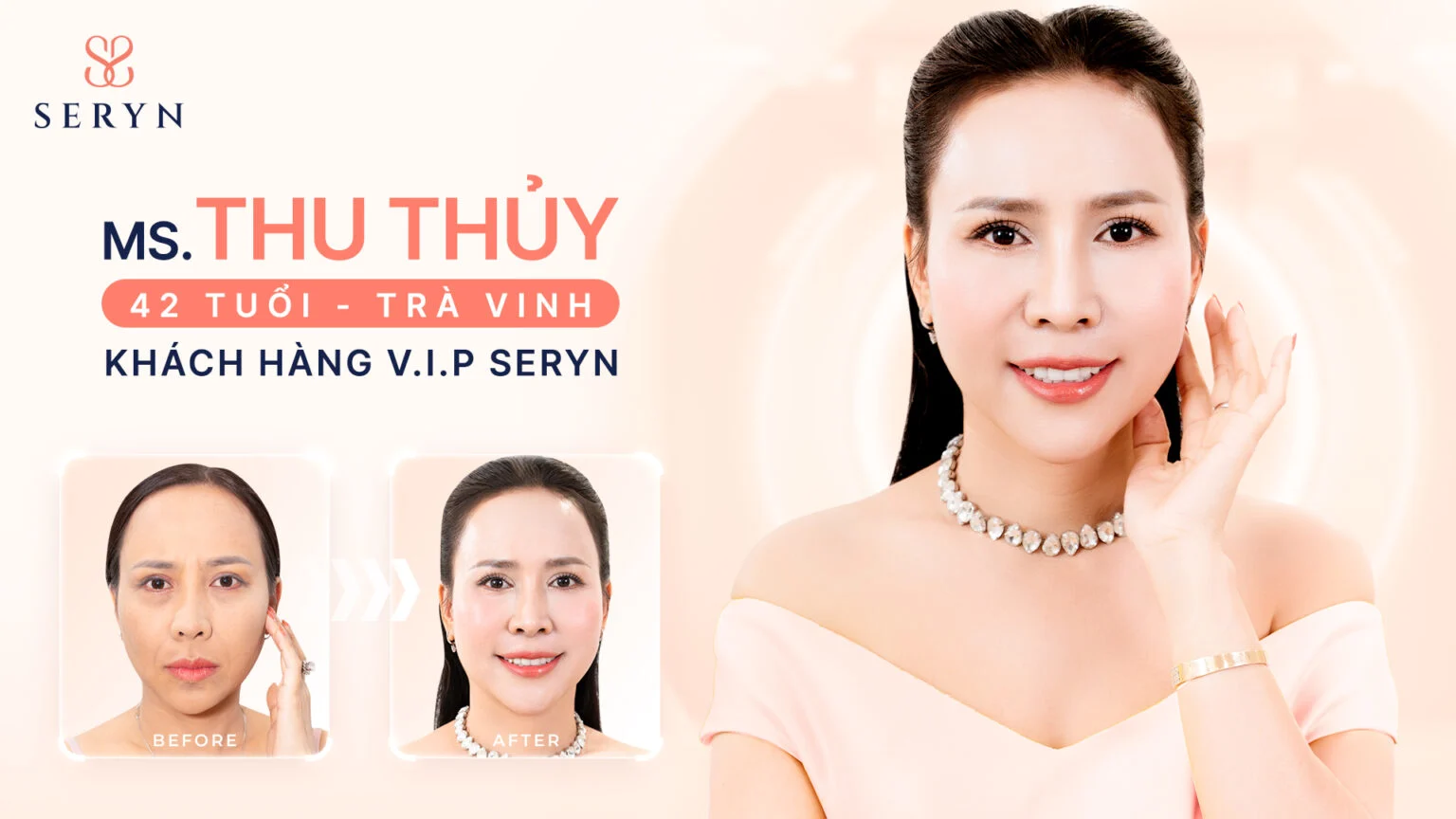 uu-dai-lam-dep-tai-phong-kham-seryn-t5-2